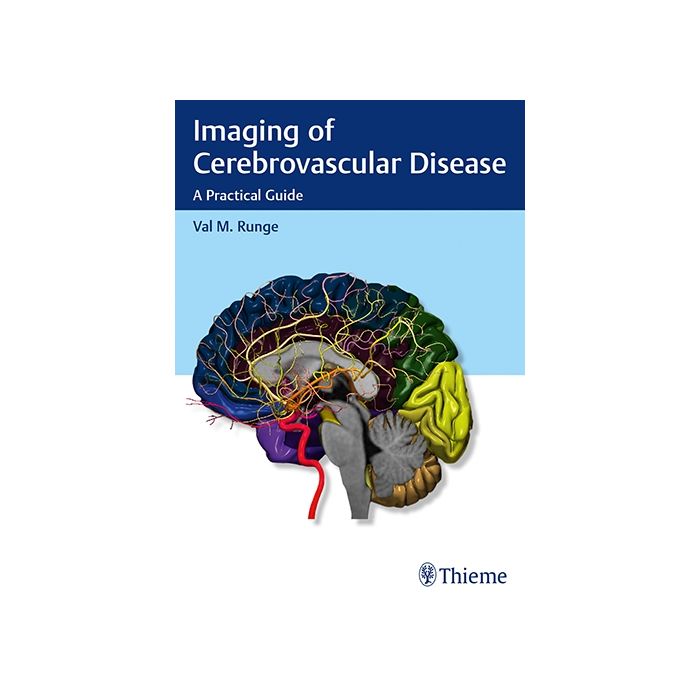 Imaging of Cerebrovascular Disease. A Practical Guide  Runge Val M.  Thieme Medical Publishers  9781626232488