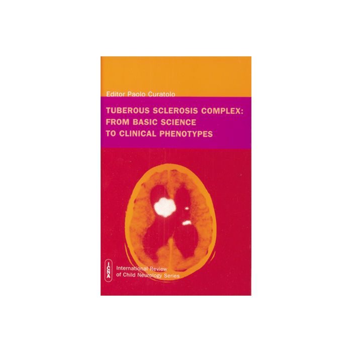 Tuberous Sclerosis Complex : From Basic Science to Clinical Phenotypes  Curatolo Paolo  Wiley - Blackwell  9781898683391