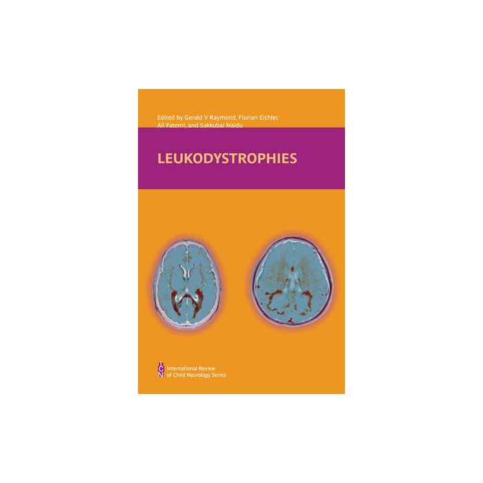 Leukodystrophies Raymond Gerald V.; Eichler Florian S.; Fatemi Ali; Naidu Sakkubai Wiley - Blackwell 9781907655098 Leukodystrophies Raymond Gerald V.; Eichler Florian S.; Fatemi Ali; Naidu Sakkubai Wiley - Blackwell 9781907655098