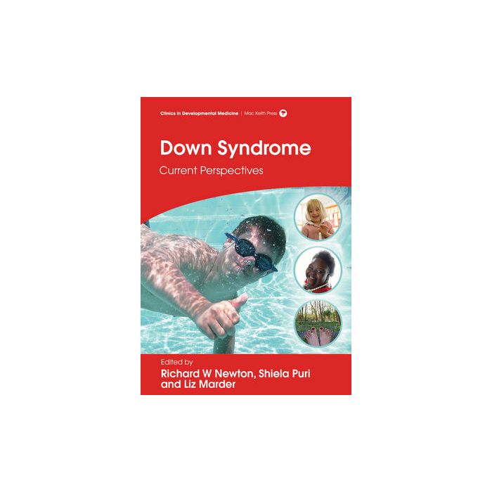 Down Syndrome: Current Perspectives  Newton Richard W.; Marder Liz; Puri Shiela C.  Wiley-Blackwell  9781909962477
