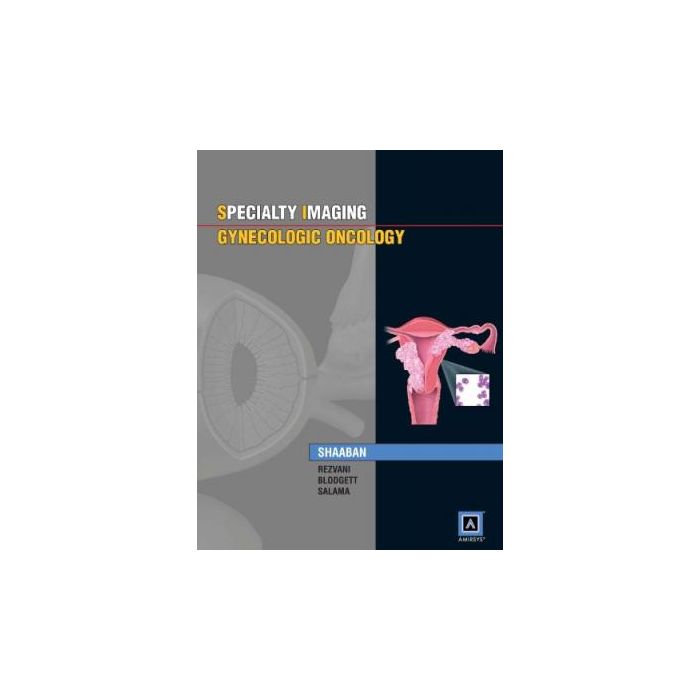 Specialty Imaging: Gynecologic Oncology  Shaaban Akram M.; Rezvani Maryam; Blodgett Todd M.  LIPPINCOTT Williams and Wilkins  9781931884228 Specialty Imaging: Gynecologic Oncology  Shaaban Akram M.; Rezvani Maryam; Blodgett Todd M.  LIPPINCOTT Williams and Wilkins  9781931884228