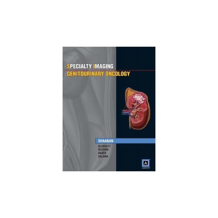 Specialty Imaging: Genitourinary Oncology Shaaban Akram M.; Blodgett Todd M.; Rezvani Maryam; Bauer David LIPPINCOTT Williams and Wilkins 9781931884242 Specialty Imaging: Genitourinary Oncology Shaaban Akram M.; Blodgett Todd M.; Rezvani Maryam; Bauer David LIPPINCOTT Williams and Wilkins 9781931884242