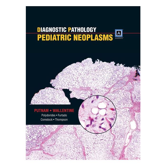 Diagnostic Pathology: Pediatric Neoplasms  Putnam Angelica R.; Wallentine Jeremy C.  LIPPINCOTT Williams and Wilkins  9781931884549