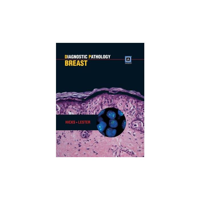 Diagnostic Pathology: Breast  Hicks David G.; Lester Susan C.  LIPPINCOTT Williams and Wilkins  9781931884570