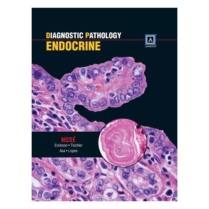 Diagnostic Pathology: Endocrine  Nose Vania; Asa Sylvia L.; Erickson Lori A.; Lopes Beatriz S.; Tischler Arthur S.  LIPPINCOTT Williams and Wilkins  9781931884594