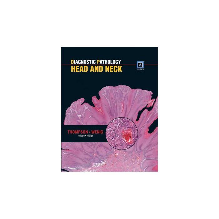 Diagnostic Pathology: Head and Neck  Thompson Lester D.R.; Wenig Bruce M.  LIPPINCOTT Williams and Wilkins  9781931884617
