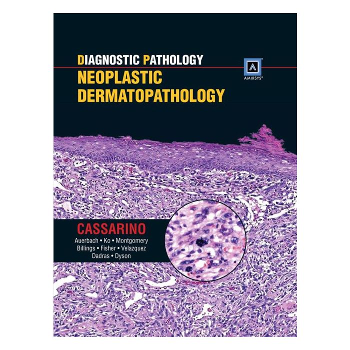 Diagnostic Pathology: Neoplastic Dermatopathology Cassarino David S. LIPPINCOTT Williams and Wilkins 9781931884648 Diagnostic Pathology: Neoplastic Dermatopathology Cassarino David S. LIPPINCOTT Williams and Wilkins 9781931884648