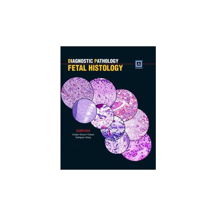 Diagnostic Pathology: Fetal Histology Comstock Jessica M.; Furtado Larissa V.; Bryson Staci LIPPINCOTT Williams and Wilkins 9781931884686 Diagnostic Pathology: Fetal Histology Comstock Jessica M.; Furtado Larissa V.; Bryson Staci LIPPINCOTT Williams and Wilkins 9781931884686