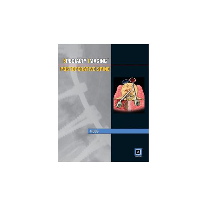 Specialty Imaging: Postoperative Spine  Ross Jeffrey S.  LIPPINCOTT Williams and Wilkins  9781931884891