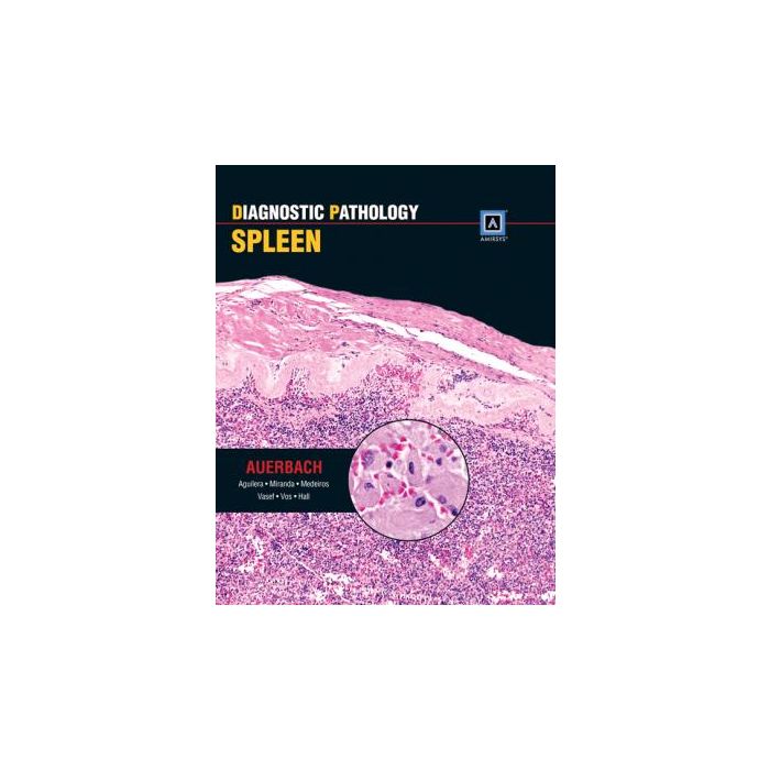 Diagnostic Pathology: Spleen - Auerbach Aaron - Lippincott Williams and Wilkins - 9781931884983