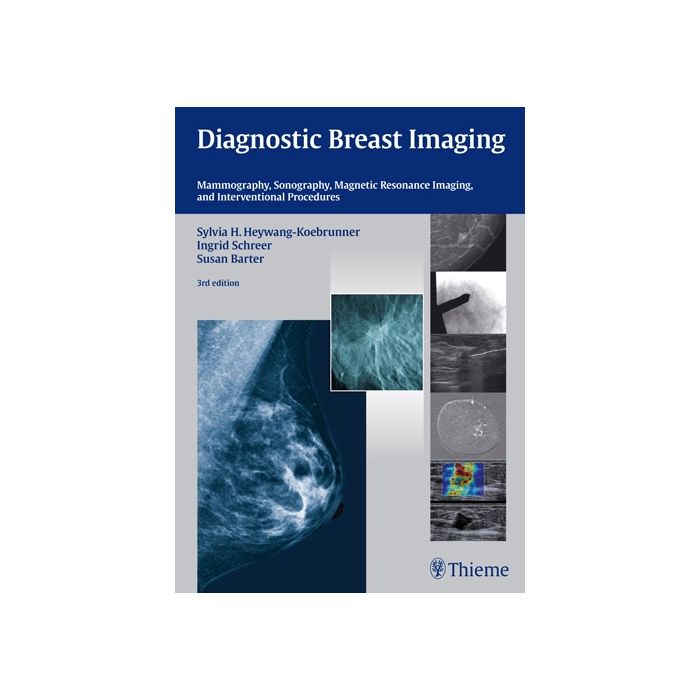 Diagnostic Breast Imaging. Mammography, Sonography, Magnetic Resonance Imaging, and Interventional Procedures  Heywang-Koebrunner Sylvia H.; Schreer Ingrid; Barter Susan  Thieme Medical Publishers  9783131028938