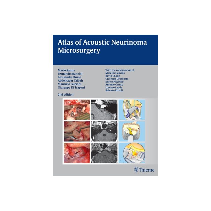 Atlas of Acoustic Neurinoma Microsurgery  Sanna Mario; Mancini Fernando; Russo Alessandra; Taibah Abdelkader; Falcioni Maurizio; Di Trapani Giuseppe  Thieme Medical Publishers  9783131102829