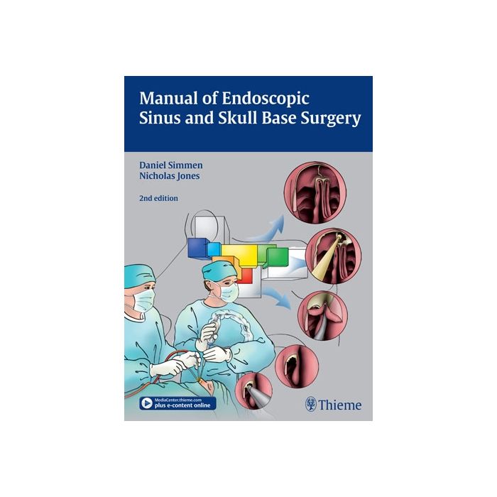Manual of Endoscopic Sinus and Skull Base Surgery  Simmen Daniel; Jones Nick S.  Thieme Medical Publishers  9783131309723