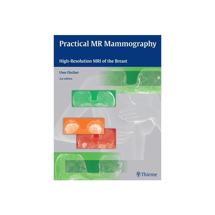 Practical MR Mammography. High-Resolution MRI of the Breast, 2/ed.  Fischer Uwe  Thieme Medical Publishers  9783131320322