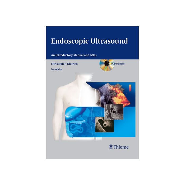Endoscopic Ultrasound. An Introductory Manual and Atlas, 2/ed. Dietrich Christoph Frank Thieme Medical Publishers 9783131431523 Endoscopic Ultrasound. An Introductory Manual and Atlas, 2/ed. Dietrich Christoph Frank Thieme Medical Publishers 9783131431523