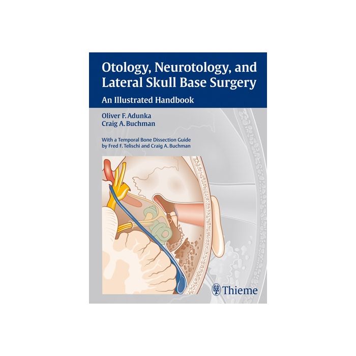 Otology, Neurotology, and Lateral Skull Base Surgery. An Illustrated Handbook Adunka Oliver Franz; Buchman Craig A. Thieme Medical Publishers 9783131450210 Otology, Neurotology, and Lateral Skull Base Surgery. An Illustrated Handbook Adunka Oliver Franz; Buchman Craig A. Thieme Medical Publishers 9783131450210
