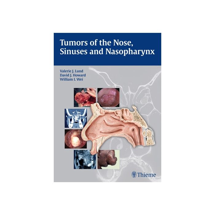 Tumors of the Nose, Sinuses and Nasopharynx  Lund Valerie J.; Howard David J.; Wei W. I.  Thieme Medical Publishers  9783131471918