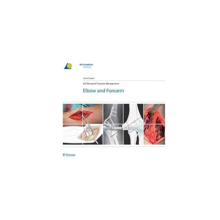 AO Manual of Fracture Management: Elbow & Forearm  Jupiter Jesse B.  Thieme Medical Publishers  9783131492715 AO Manual of Fracture Management: Elbow & Forearm  Jupiter Jesse B.  Thieme Medical Publishers  9783131492715