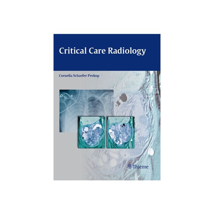 Critical Care Radiology  Schaefer-Prokop Cornelia  Thieme Medical Publishers  9783131500519