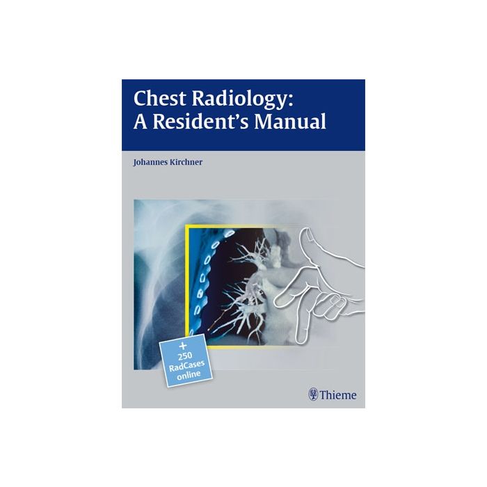 Chest Radiology: A Resident's Manual Kirchner Johannes Thieme Medical Publishers 9783131538710 Chest Radiology: A Resident's Manual Kirchner Johannes Thieme Medical Publishers 9783131538710