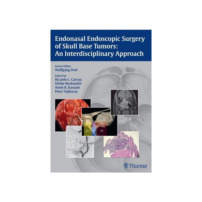Endonasal Endoscopic Surgery of Skull Base Tumors. An Interdisciplinary Approach  Carrau Ricardo L.; Bockmuehl Ulrike; Kassam Amin B.; Vajkoczy Peter; Draf Wolfgang  Thieme Medical Publishers  9783131546715