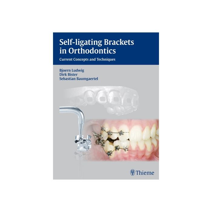 Self-ligating Brackets in Orthodontics. Current Concepts and Techniques  Ludwig Bjoern; Bister Dirk; Baumgaertel Sebastian  Thieme Medical Publishers  9783131547019 Self-ligating Brackets in Orthodontics. Current Concepts and Techniques  Ludwig Bjoern; Bister Dirk; Baumgaertel Sebastian  Thieme Medical Publishers  9783131547019