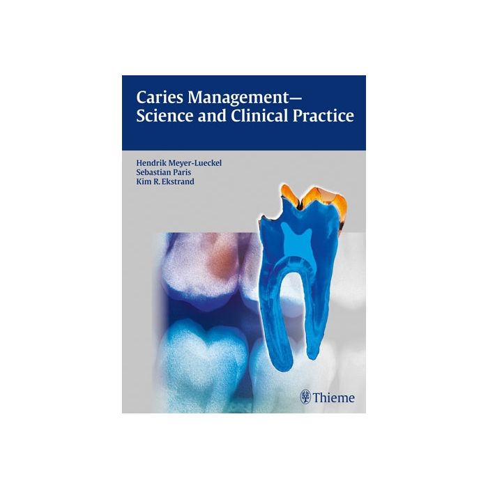 Caries Management - Science and Clinical Practice  Meyer-lueckel Hendrik; Paris Sebastian; Ekstrand Kim R.  Thieme Medical Publishers  9783131547118