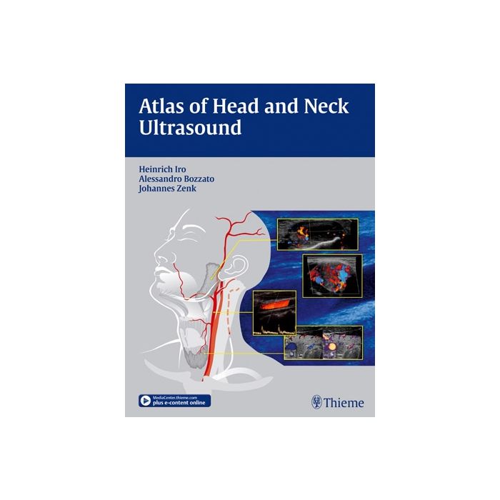 Atlas of Head and Neck Ultrasound Iro Heinrich; Zenk Johannes; Bozzato Alessandro Thieme Medical Publishers 9783131603517 Atlas of Head and Neck Ultrasound Iro Heinrich; Zenk Johannes; Bozzato Alessandro Thieme Medical Publishers 9783131603517