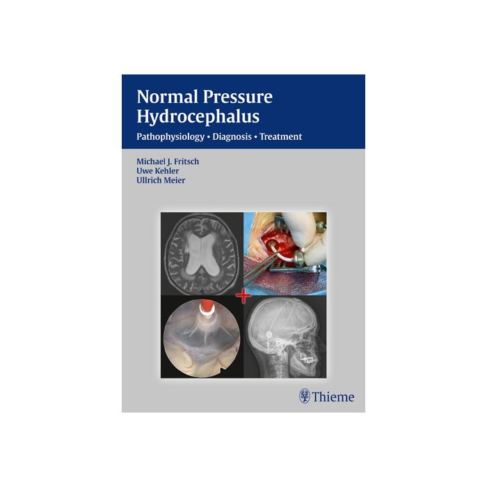 NPH - Normal Pressure Hydrocephalus. Pathophysiology - Diagnosis - Treatment  Fritsch Michael J.; Kehler Uwe; Meier Ullrich  Thieme Medical Publishers  9783131646019