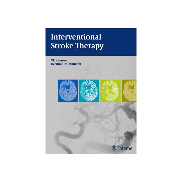 Interventional Stroke Therapy Jansen Olav; Brueckmann Hartmut Thieme Medical Publishers 9783131699213 Interventional Stroke Therapy Jansen Olav; Brueckmann Hartmut Thieme Medical Publishers 9783131699213