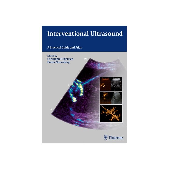 Interventional Ultrasound. A Practical Guide and Atlas  Dietrich Christoph Frank; Nuernberg Pieter  Thieme Medical Publishers  9783131708212
