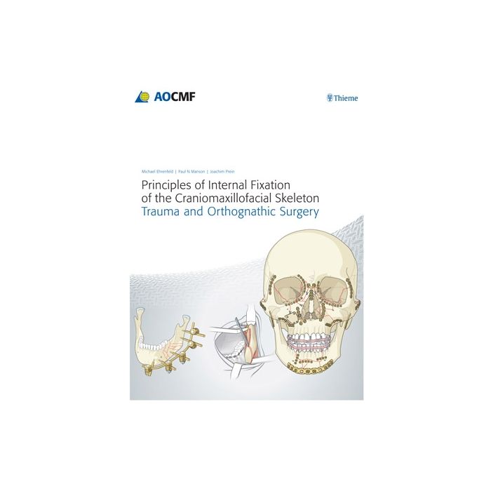 Principles of Internal Fixation of the Craniomaxillofacial Skeleton  Ehrenfeld Michael; Manson Paul N.; Prein Joachim  Thieme Medical Publishers  9783131714817 Principles of Internal Fixation of the Craniomaxillofacial Skeleton  Ehrenfeld Michael; Manson Paul N.; Prein Joachim  Thieme Medical Publishers  9783131714817