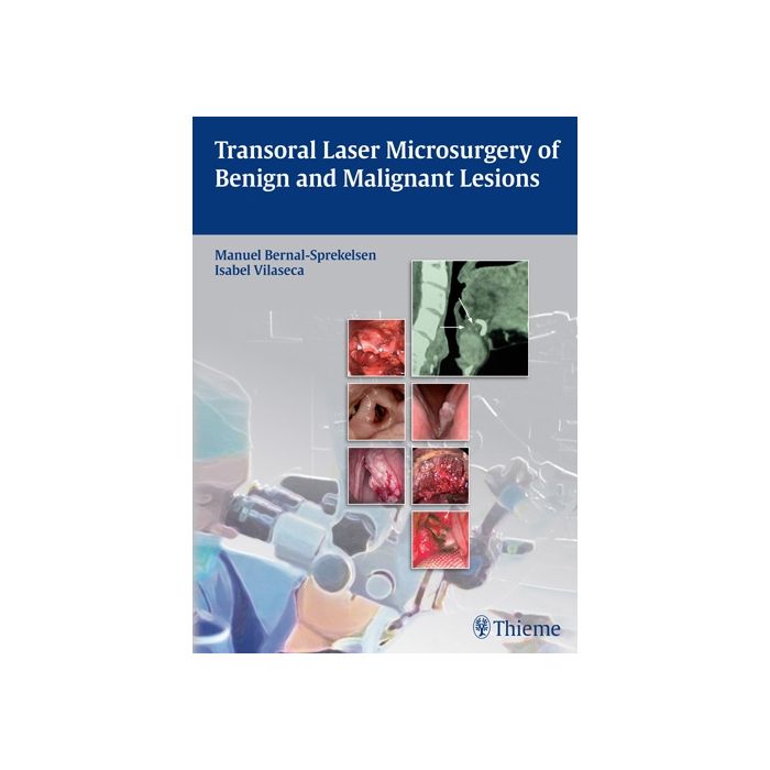 Transoral Laser Microsurgery of Benign and Malignant Lesions  Bernal-Sprekelsen Manuel; Vilaseca Isabel  Thieme Medical Publishers  9783131723918