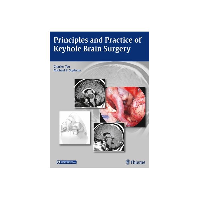Principles and Practice of Keyhole Brain Surgery Teo Charles; Sughrue Michael E. Thieme Medical Publishers 9783131758514 Principles and Practice of Keyhole Brain Surgery Teo Charles; Sughrue Michael E. Thieme Medical Publishers 9783131758514