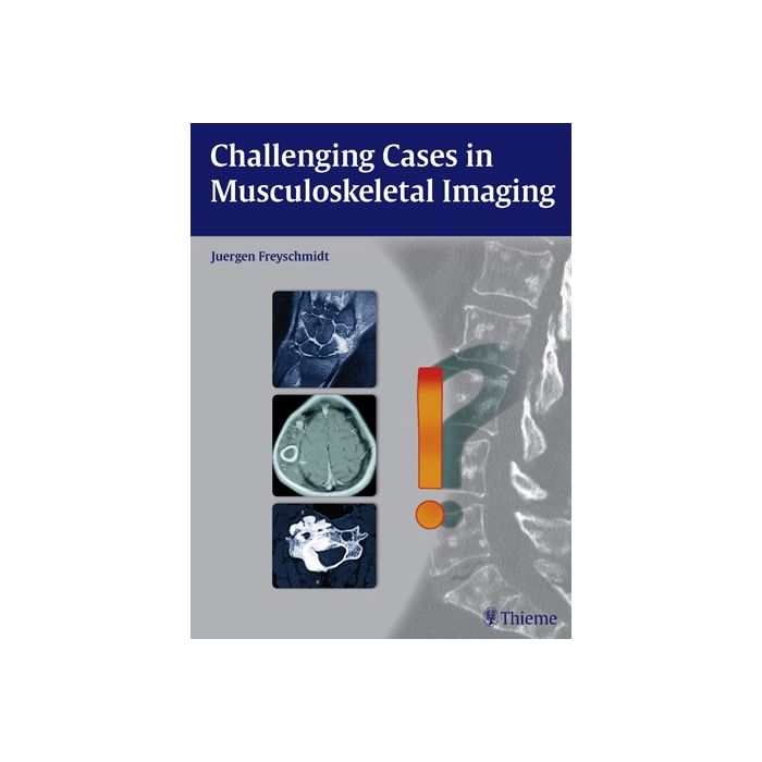 Challenging Cases in Musculoskeletal Imaging  Freyschmidt Jürgen  Thieme Medical Publishers  9783131764010