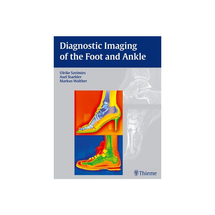 Diagnostic Imaging of the Foot and Ankle  Szeimies Ulrike; Stäbler Axel; Walther Markus  Thieme Medical Publishers  9783131764614