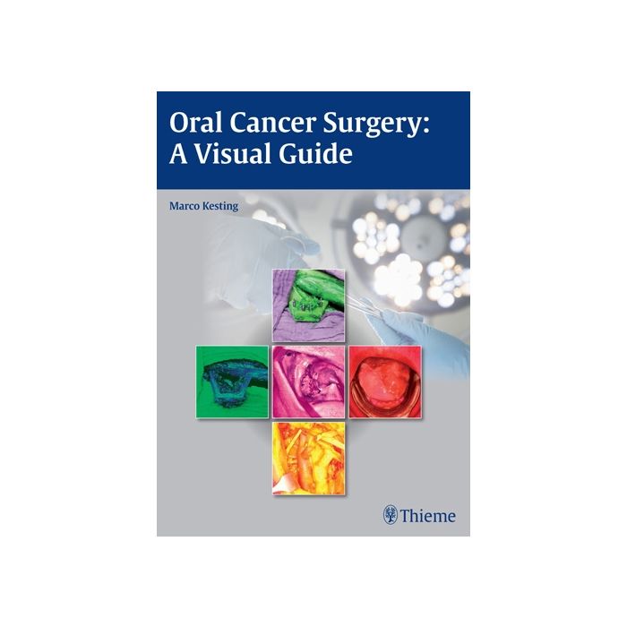 Oral Cancer Surgery: A Visual Guide  Kesting Marco R.  Thieme Medical Publishers  9783131994011