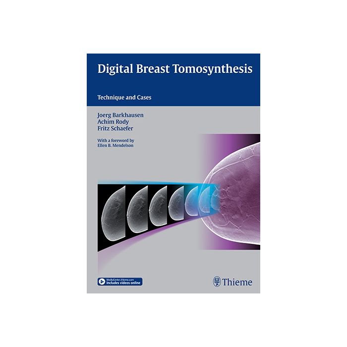 Digital Breast Tomosynthesis. Technique and Cases  Barkhausen Joerg; Rody Achim; Schäfer Fritz K. W.  Thieme  9783132031616