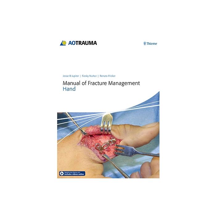 Manual of Fracture Management - Hand Jupiter Jesse B.; Nunez Fiesky; Fricker Renato M. Thieme Medical Publishers 9783132215818 Manual of Fracture Management - Hand Jupiter Jesse B.; Nunez Fiesky; Fricker Renato M. Thieme Medical Publishers 9783132215818