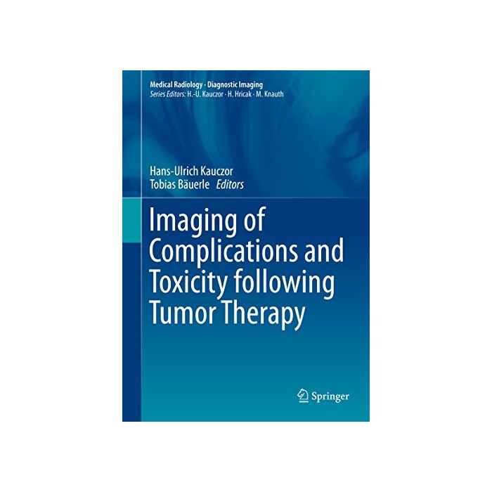 Imaging of Complications and Toxicity following Tumor Therapy Kauczor Hans-Ulrich; Bäuerle Tobias Springer Verlag 9783319128405 Imaging of Complications and Toxicity following Tumor Therapy Kauczor Hans-Ulrich; Bäuerle Tobias Springer Verlag 9783319128405