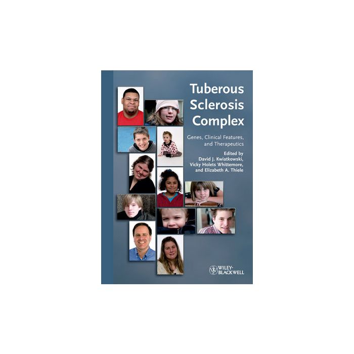 Tuberous Sclerosis Complex: Genes, Clinical Features and Therapeutics  Kwiatkowski David J.; Holets Whittemore Vicky; Thiele Elizabeth A.  Wiley-Blackwell  9783527322015