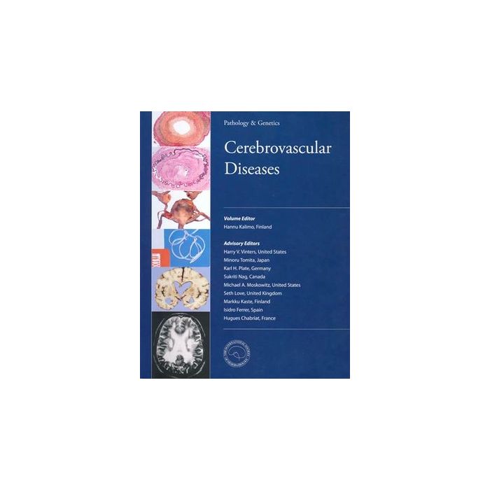 Cerebrovascular Diseases  Kalimo Hannu  Wiley - Blackwell  9783952231340