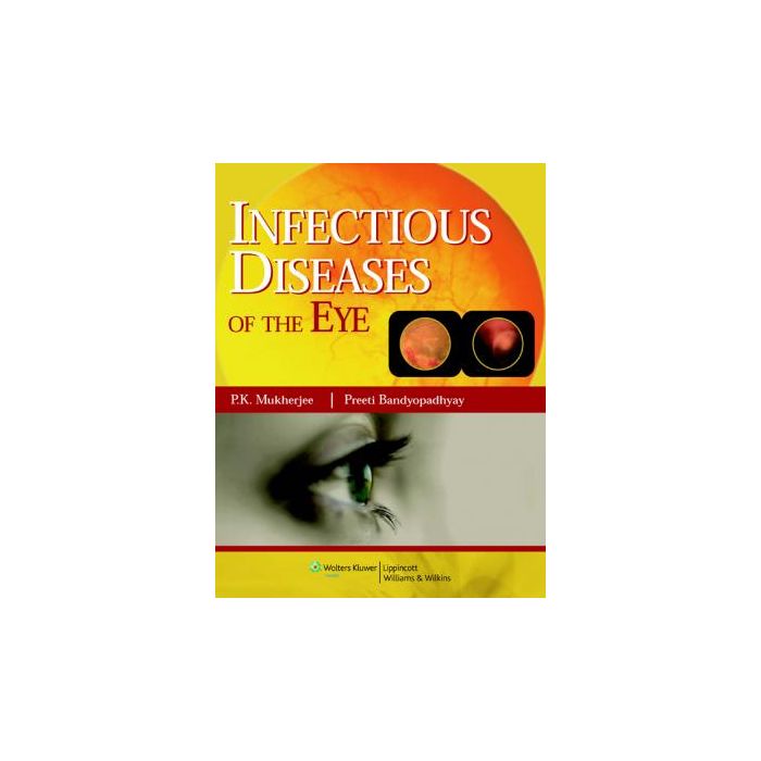 Infectious diseases of the Eyes  Mukherjee P.K.  LIPPINCOTT Williams and Wilkins  9788184731989