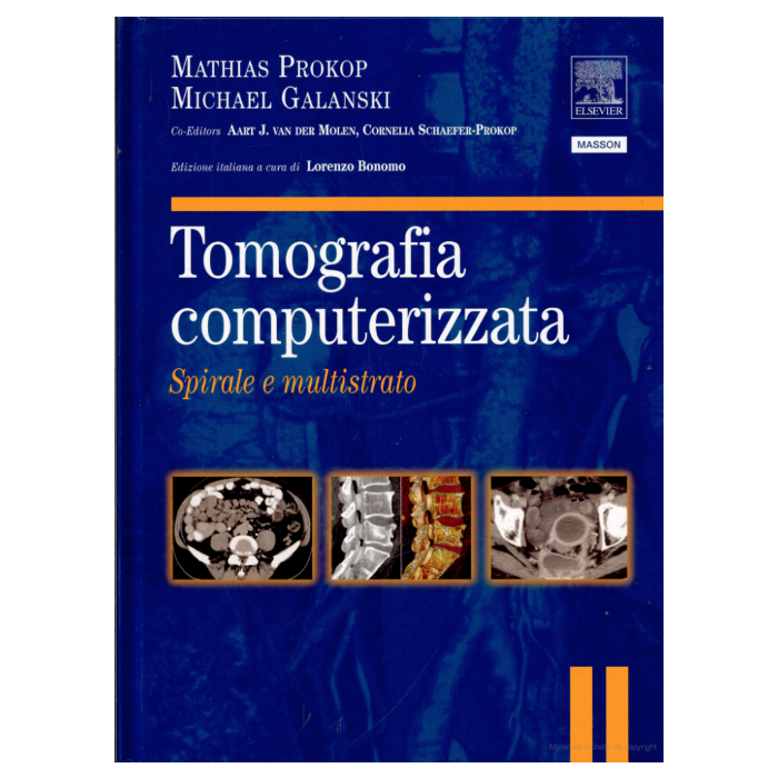 Prokop Tomografia Computerizzata spirale multistrato elsevier masson edra Prokop Tomografia Computerizzata spirale multistrato elsevier masson edra
