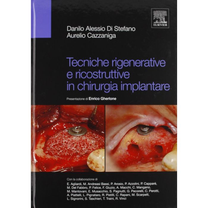 Tecniche rigenerative e ricostruttive in chirurgia implantare - Danile Alessio Di Stefano edra Tecniche rigenerative e ricostruttive in chirurgia implantare - Danile Alessio Di Stefano edra