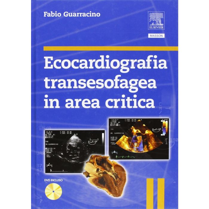 Guarracino ecocardiografia transesofagea in area critica elsevier masson edra Guarracino ecocardiografia transesofagea in area critica elsevier masson edra