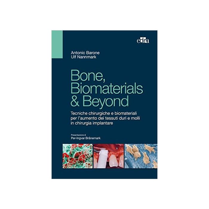 Bone, biomaterials & beyond. Tecniche chirurgiche e biomateriali per l'aumento dei tessuti duri e molli in chirurgia implantare  Barone Antonio; Nannmark Ulf  Elsevier Masson Italia  9788821439858