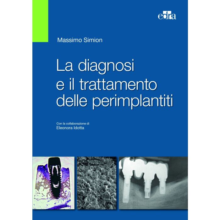 La diagnosi e il trattamento delle perimplantiti - Massimo Simion - Edra Elsevier Masson - 9788821440106 La diagnosi e il trattamento delle perimplantiti - Massimo Simion - Edra Elsevier Masson - 9788821440106
