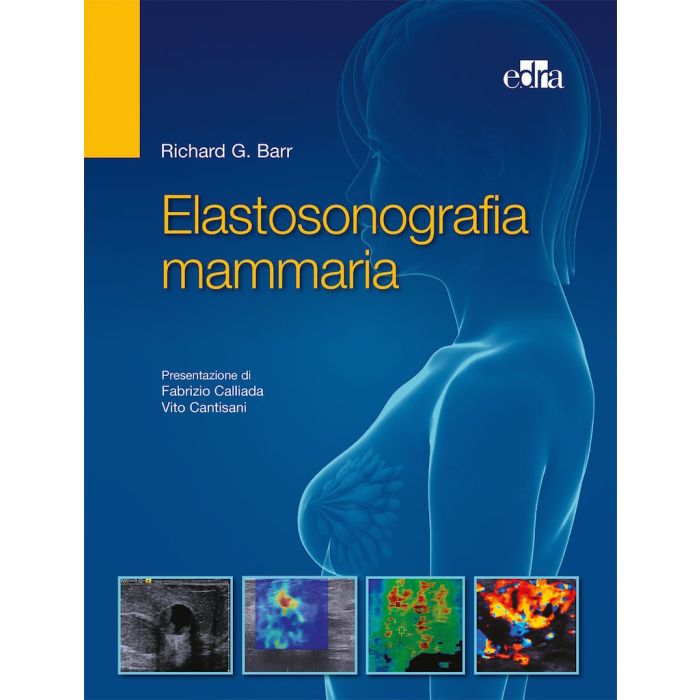 Elastosonografia Mammaria