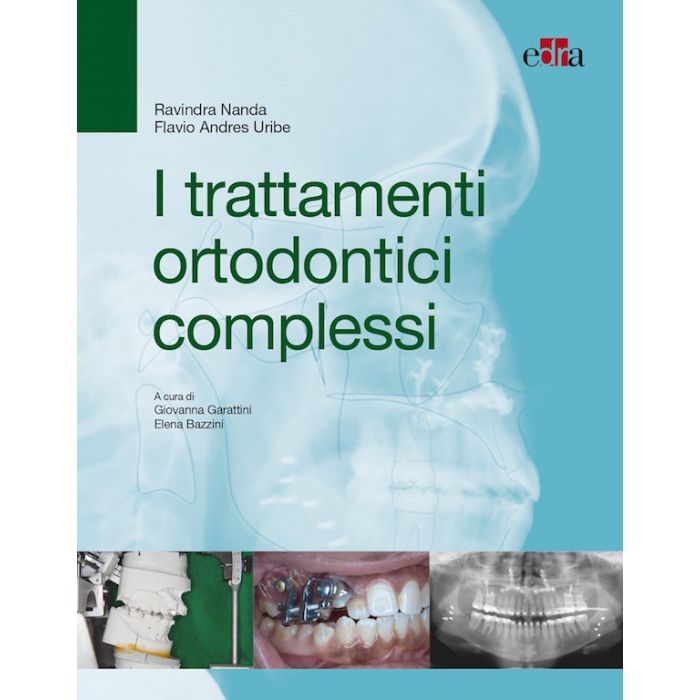 Nanda I Trattamenti Ortodontici Complessi Nanda I Trattamenti Ortodontici Complessi